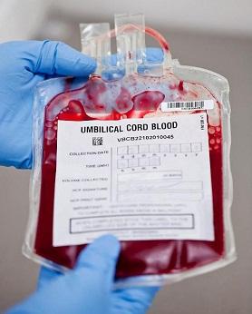 Umbilical cord blood